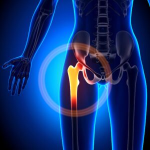 Hip pain can be caused by a variety of factors, ranging from injuries and overuse to medical conditions such as arthritis or hip dysplasia.